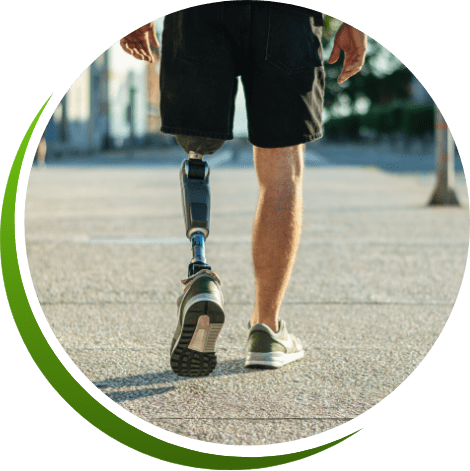 Prosthetics and Orthotics in Nerul Navi Mumbai | Shri Balaji Prosthetics