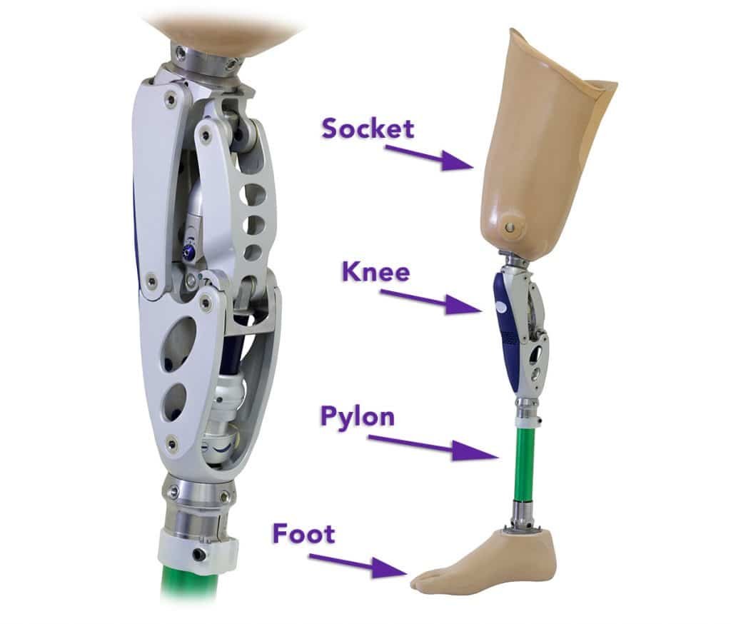 Prosthetics and Orthotics in Nerul Navi Mumbai | Shri Balaji Prosthetics